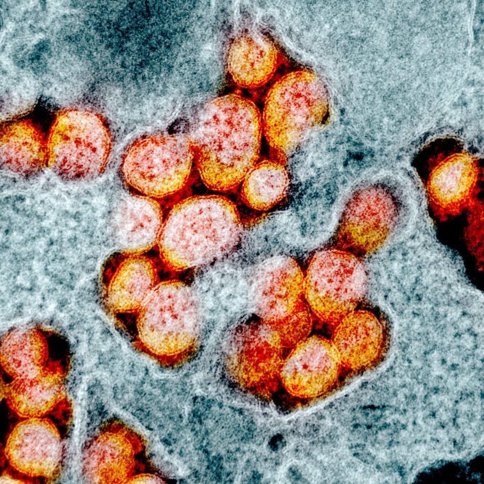 virus covid-19